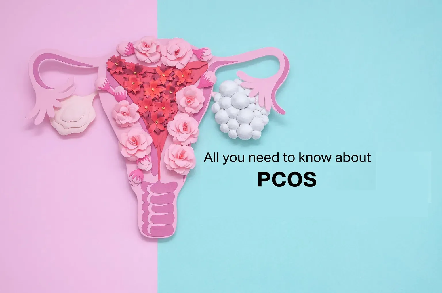 Polycystic Ovary Syndrome (PCOS)