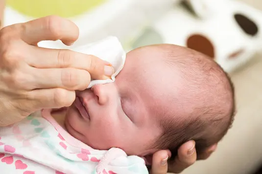 Neonatal Conjunctivitis And Tips To Prevent It