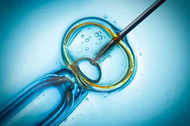 IVF process: 4 steps to getting pregnant