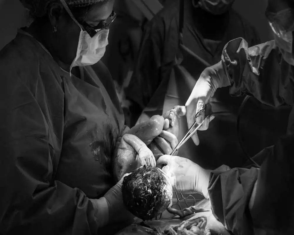 Normal vs. C-Section Delivery: Key Differences, Risks, and What Expecting Parents Should Know