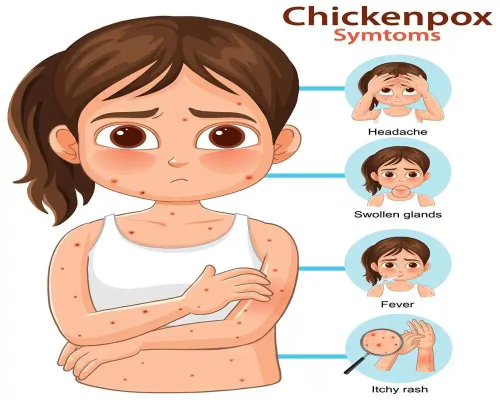 Understanding Chickenpox Symptoms: Early Signs, Stages & When to See a Doctor