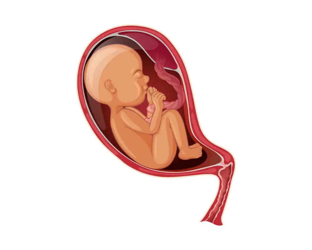 Placenta Previa: Symptoms, Causes, Risks & Treatment Options