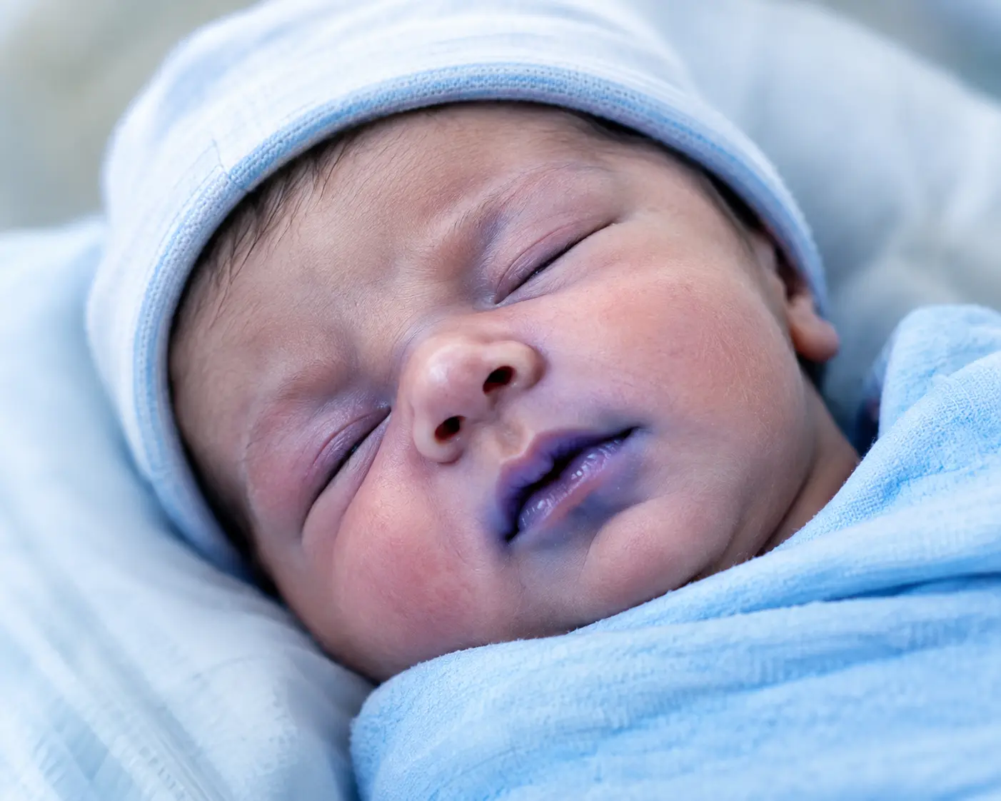 Blue Baby Syndrome: Causes, Symptoms & Treatment in Newborns