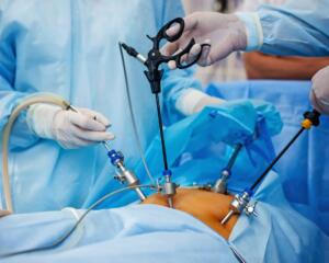 Minimally Invasive Gynecologic Surgery (MIGS)